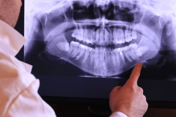 Best Emergency Dentist for Knocked-Out Tooth in New Union, TN
